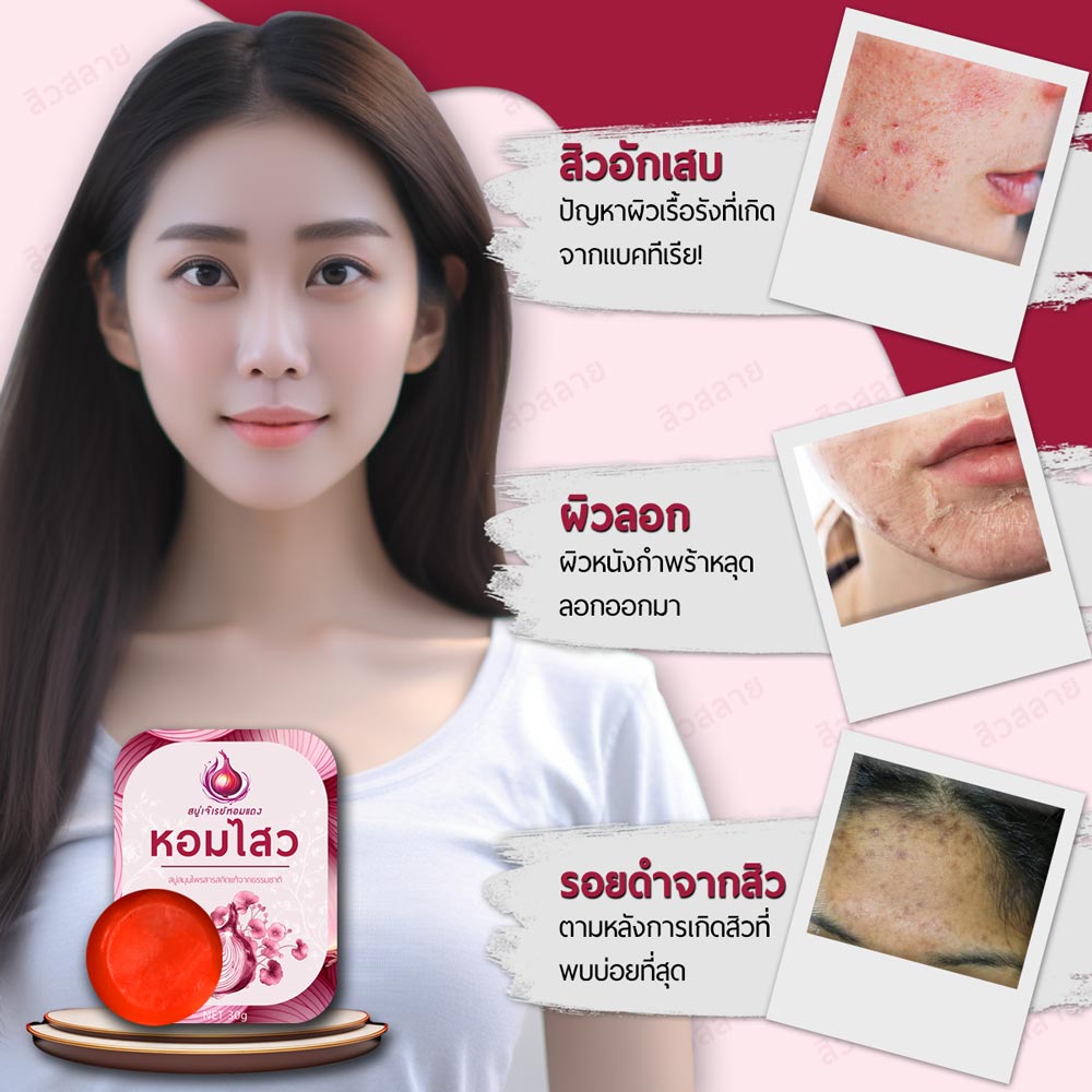 สบู่ สูตรลดสิว ลดรอยดำ #หอมไสว