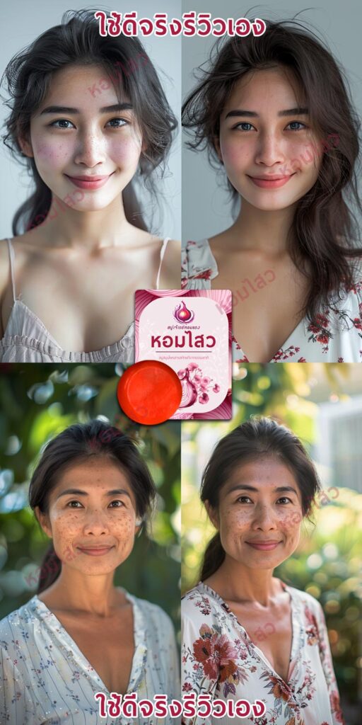รีวิวสบู่ลดสิว ลดฝ้า - สบู่หอมไสว