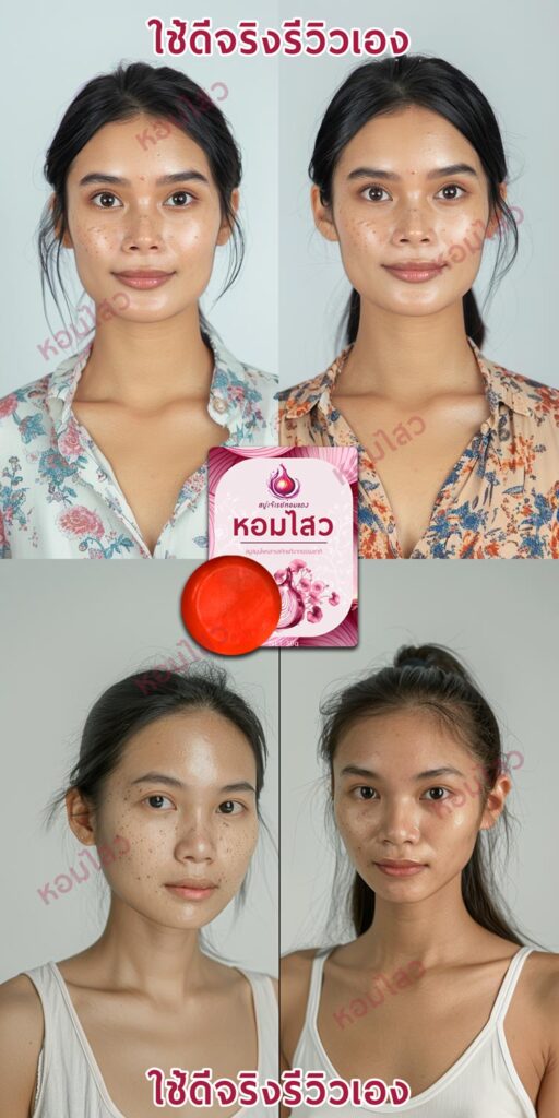 รีวิวสบู่ลดสิว ลดฝ้า - สบู่หอมไสว