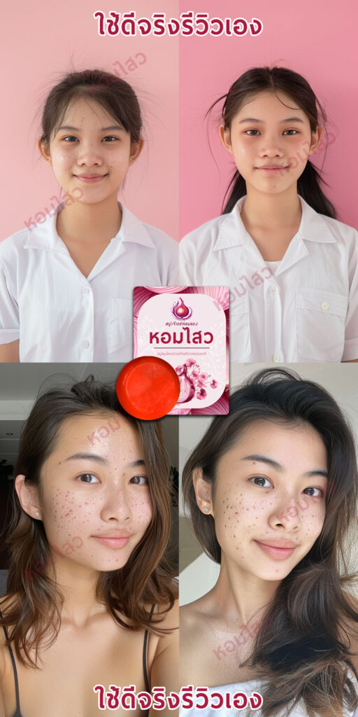 รีวิว ก่อนใช้-หลังใช้ สบู่หอมไสว