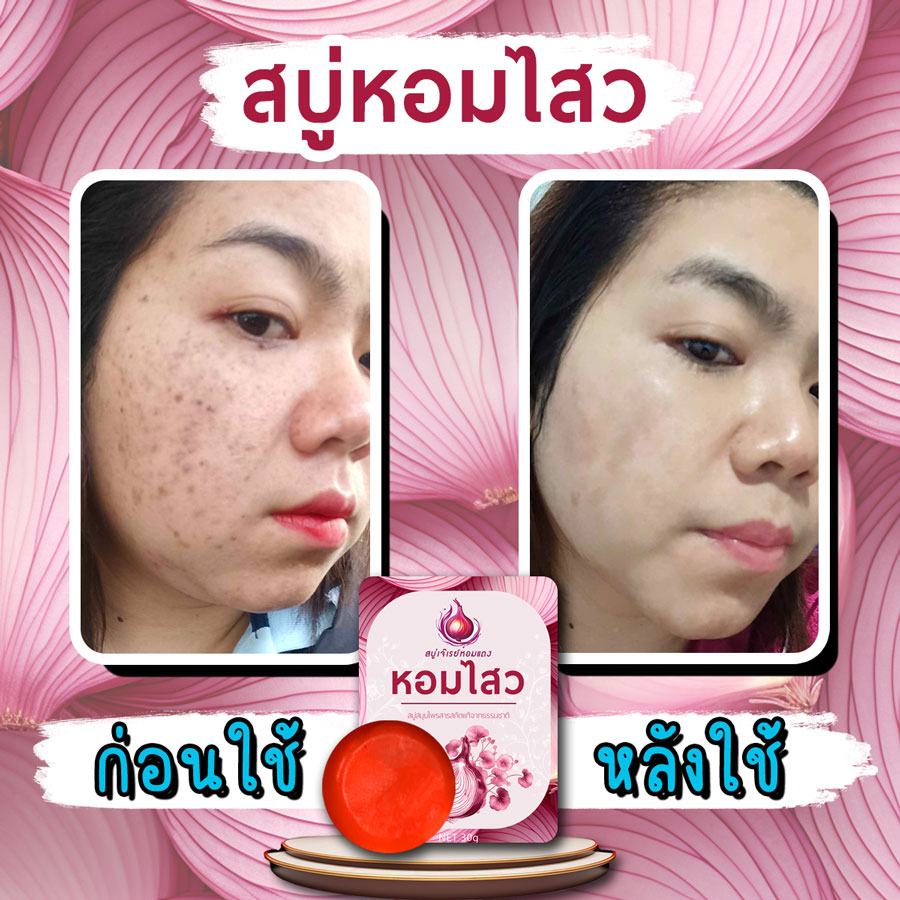 รีวิว ก่อนใช้-หลังใช้ สบู่หอมไสว
