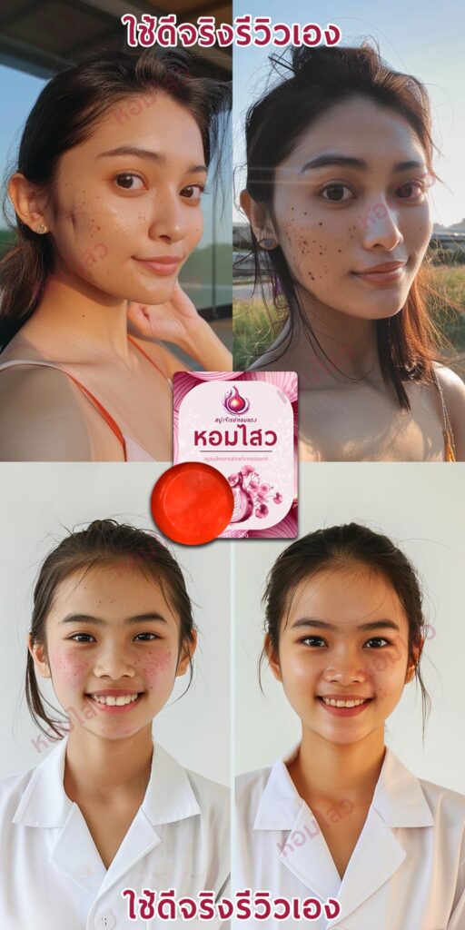 รีวิว ก่อนใช้-หลังใช้ สบู่หอมไสว - homsawai.com