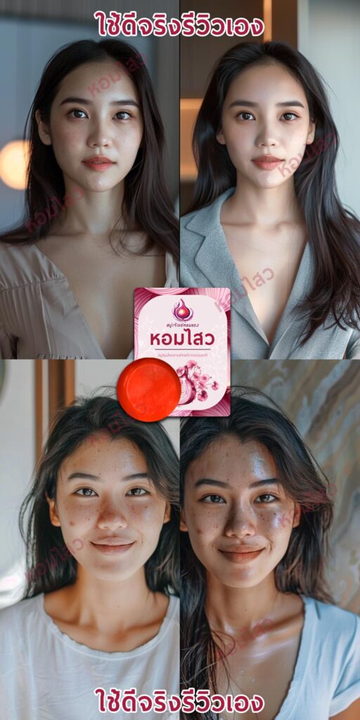รีวิวสบู่ลดสิว ลดฝ้า - สบู่หอมไสว